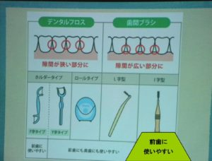 セミナー/歯の磨き方/歯周ポケット/口腔ケア